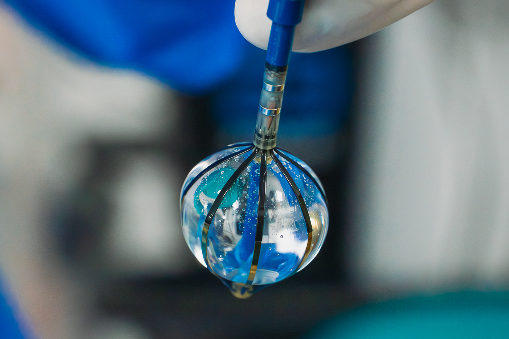 Balonowo-koszykowa technologia. Nowa metoda ablacji migotania przedsionków w UCKiK
