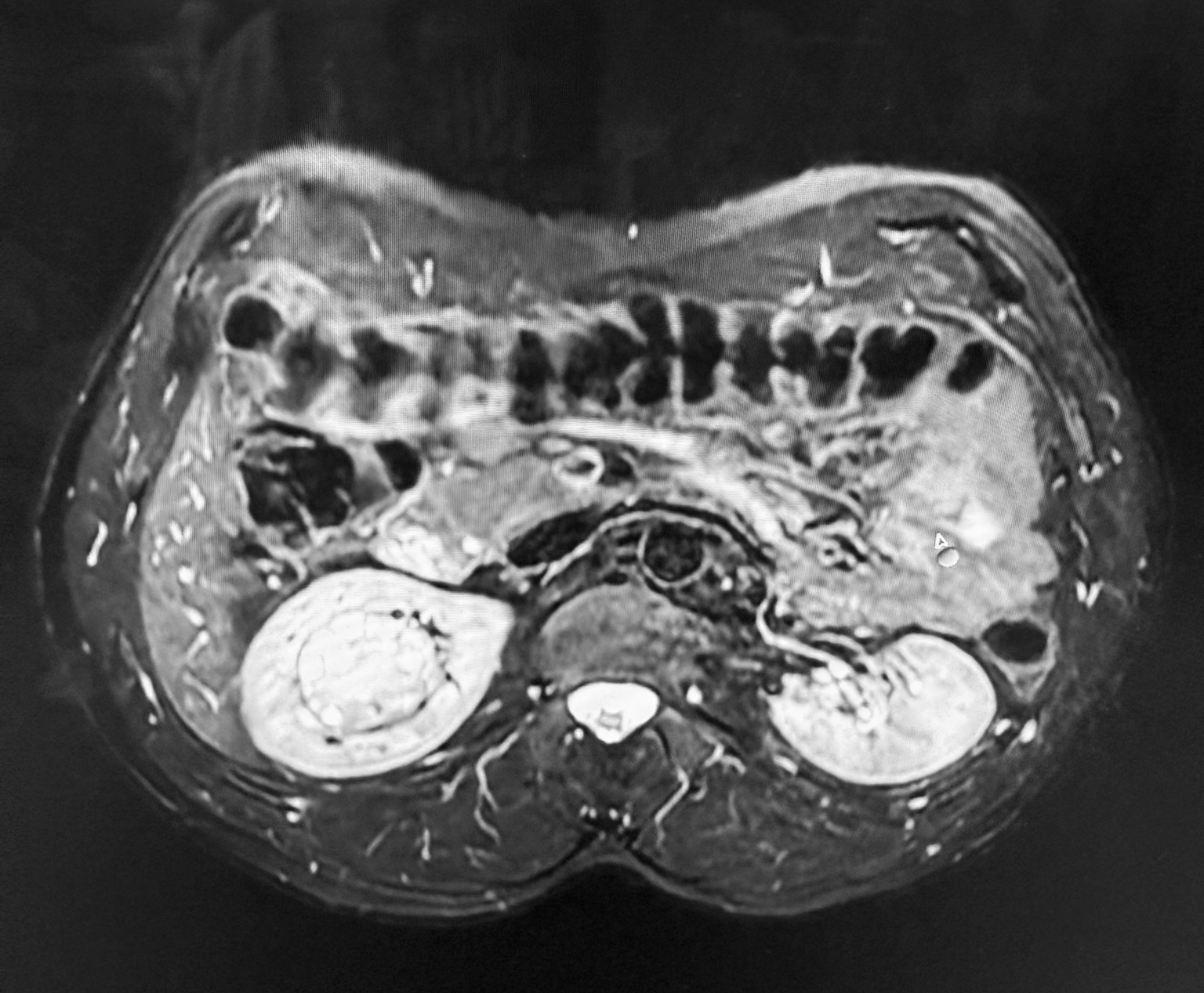 Na obrazie widoczny jest czarno biały przekrój wnętrza ciała przedstawiony w poziomie. Po lewej i prawej stronie fotografii znajdują się jasne owalne kształty otoczone ciemniejszym tłem, a pomiędzy nimi w centrum widać nieregularne struktury o różnej jasności. W górnej części obrazu biegnie pas drobnych powtarzających się kształtów przypominających pętle, a dolna część jest bardziej jednolita i ciemniejsza z pojedynczym jasnym elementem pośrodku. Całość ma symetryczny układ względem środka kadru.
